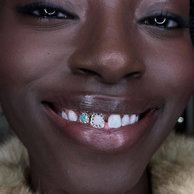 Sparkling Smiles How Tooth Gems Became a Fashion Statement