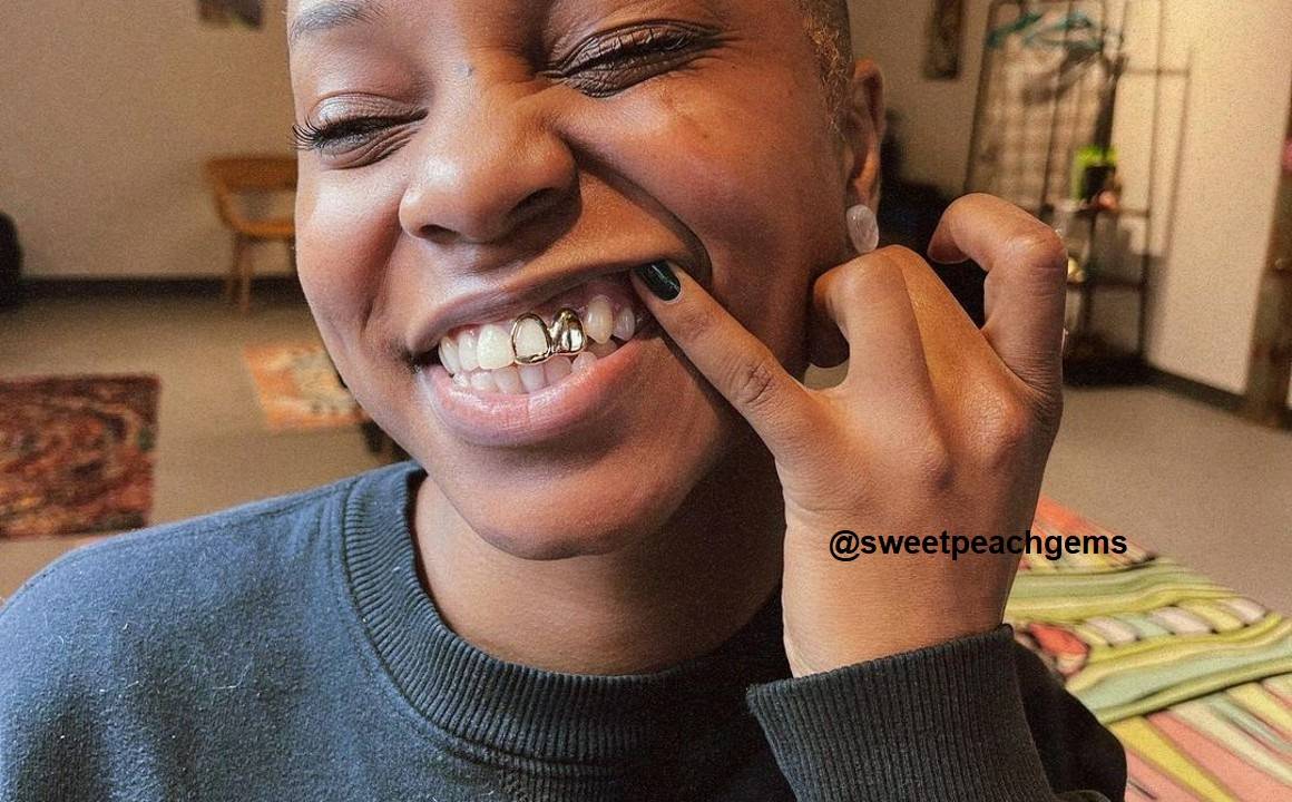 Sparkling Smiles How Tooth Gems Became a Fashion Statement
